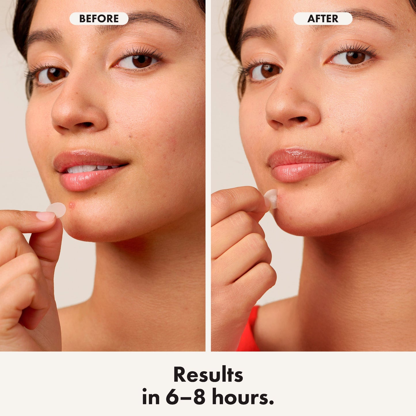 Hero Mighty Patch Original 24 Ct