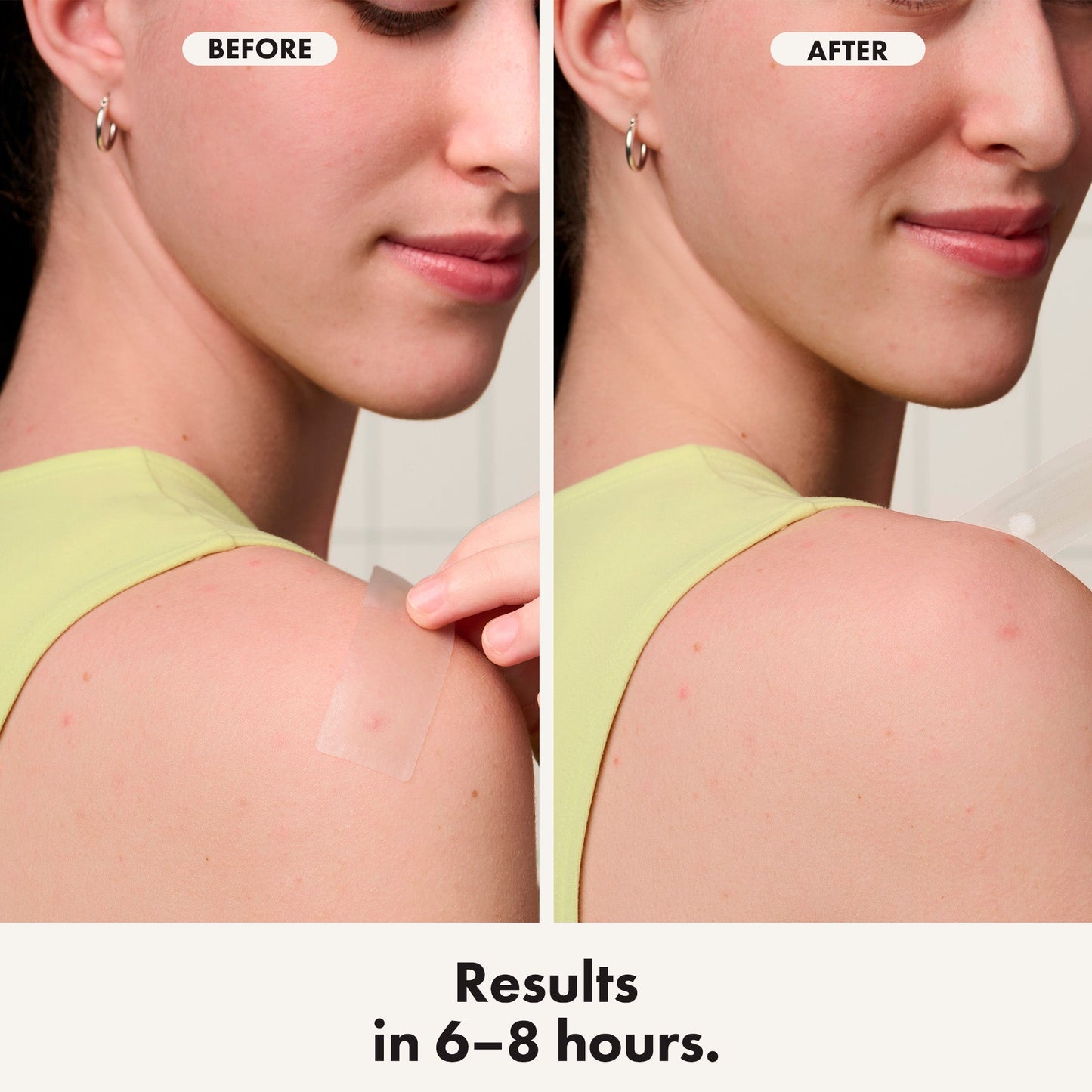 Hero Mighty Patch Surface 10