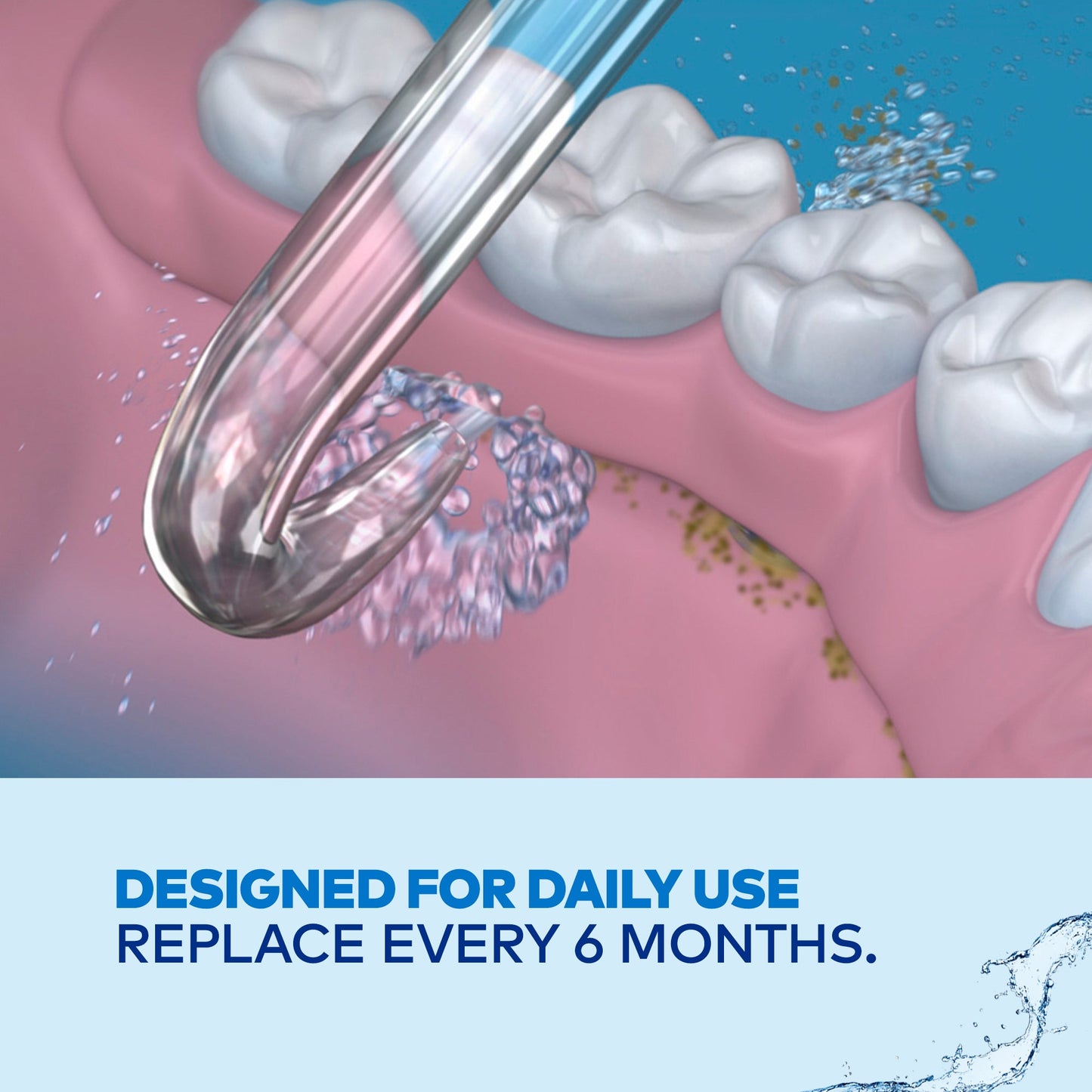 Waterpik Implant Denture Tip (DT-100E)