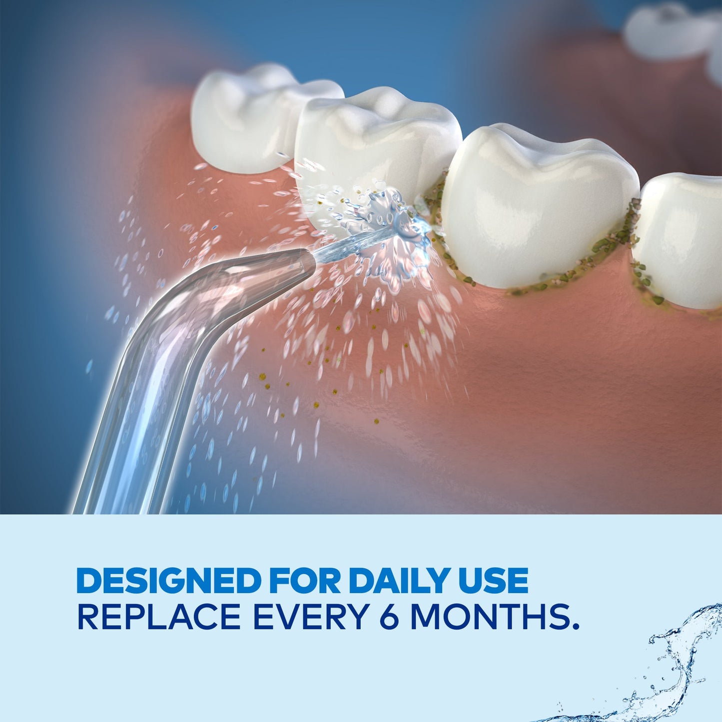 Waterpik WP JT-70E Classic Jet Tip