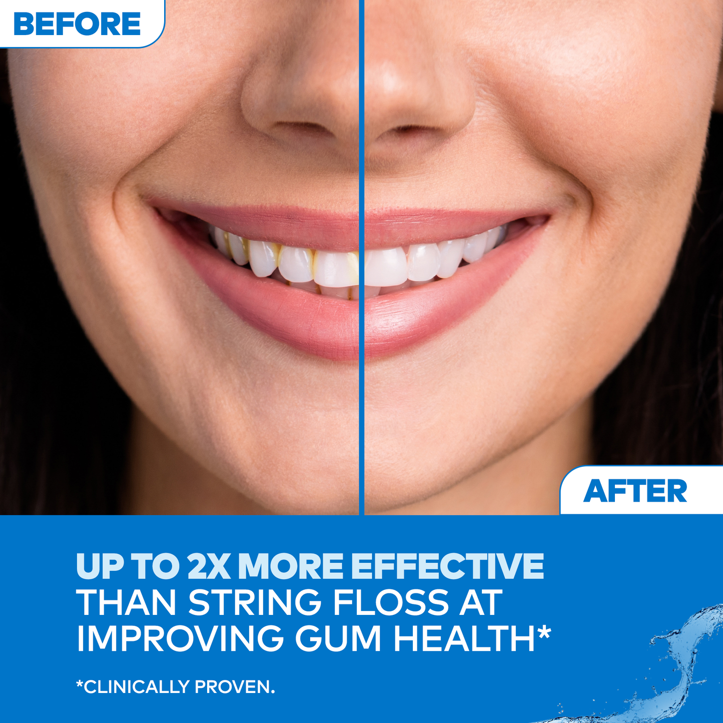 Waterpik Ultra Water Flosser – Black (WP-112)