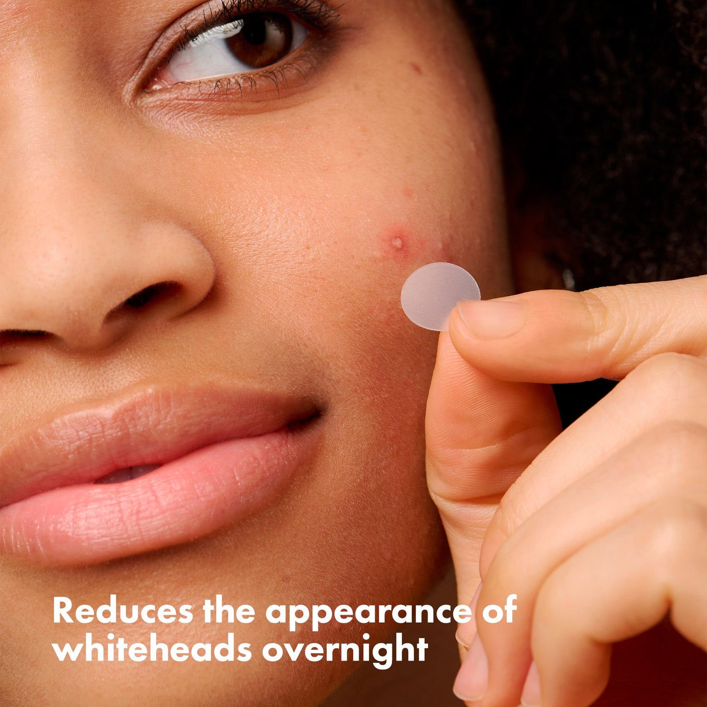 Hero Mighty Patch Original 36