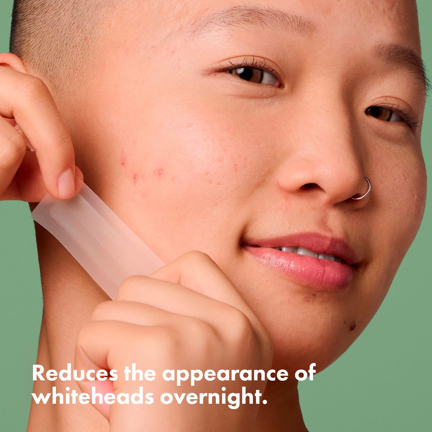 Hero Mighty Patch Surface 10