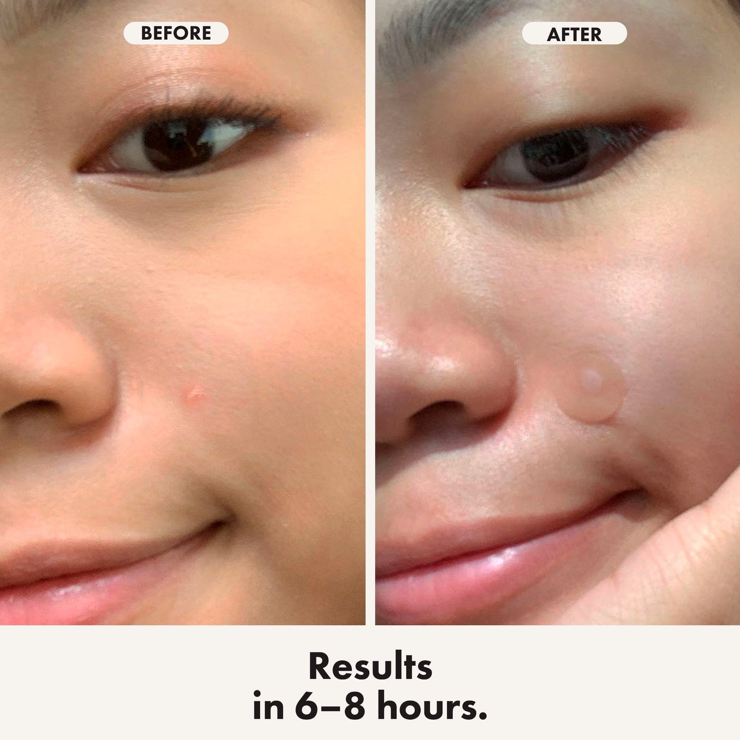 Hero Mighty Patch Duo 12