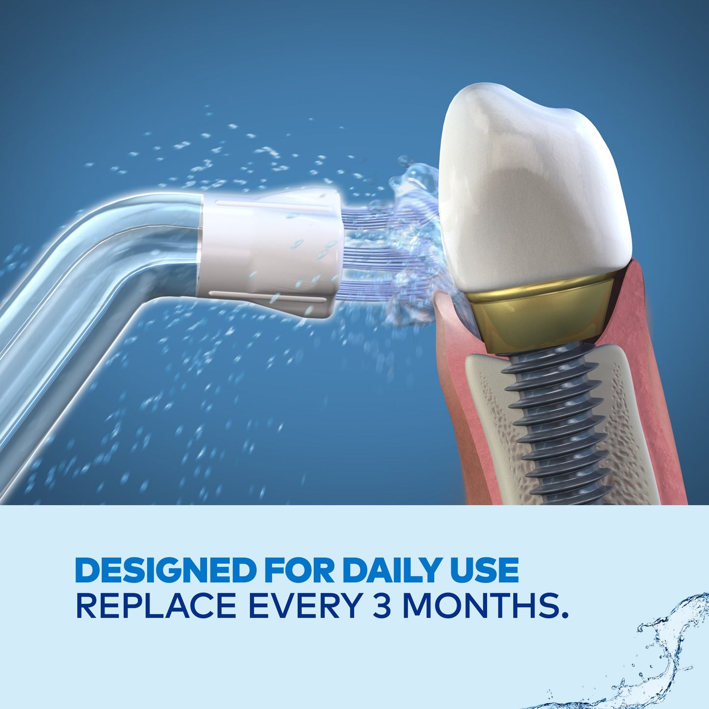 Waterpik Plaque Seeker Tip (PS-100E)