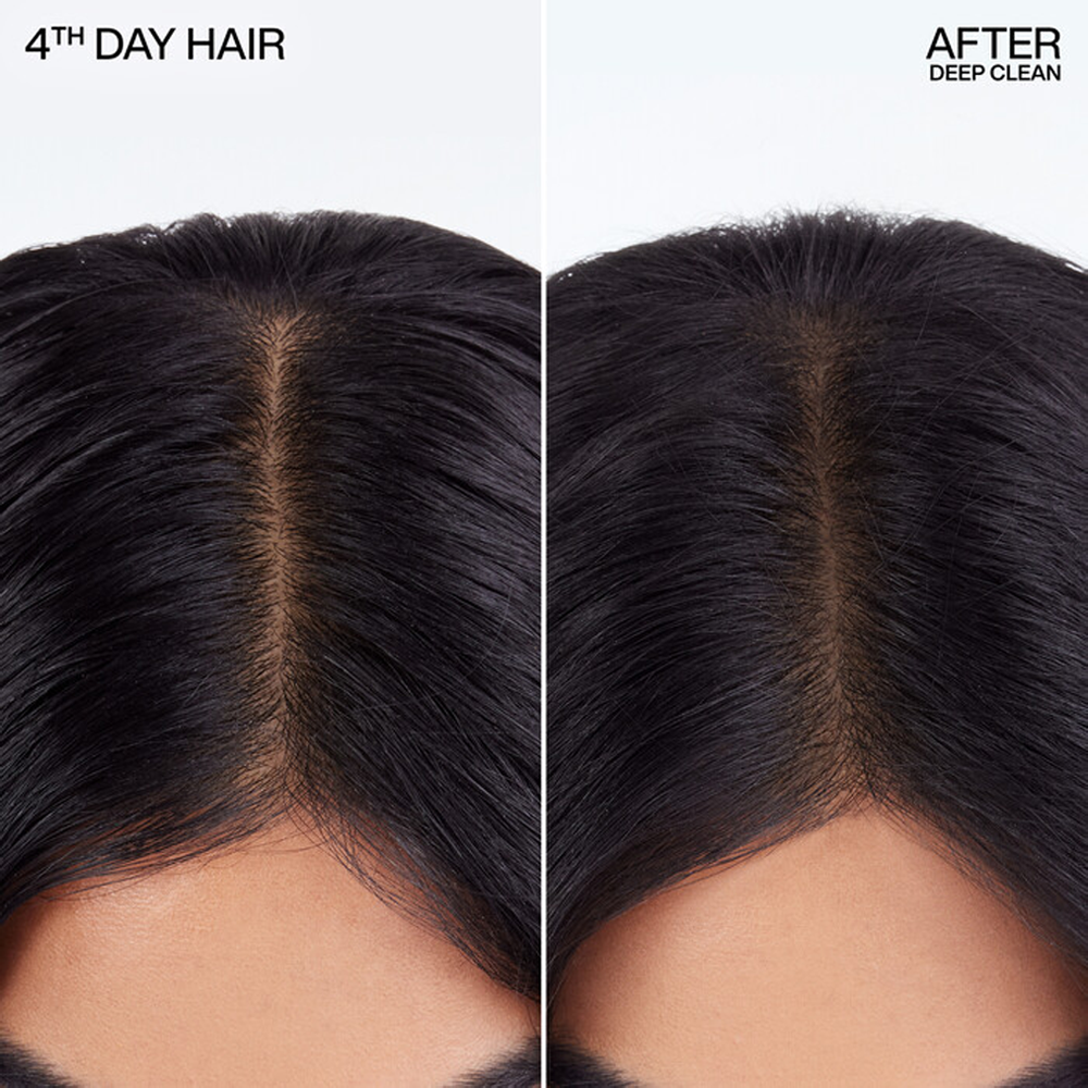 Redken Deep Clean Dry Shampoo 300 g